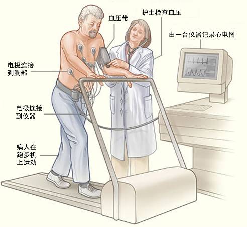 冠心病需要做哪些檢查？(圖3)